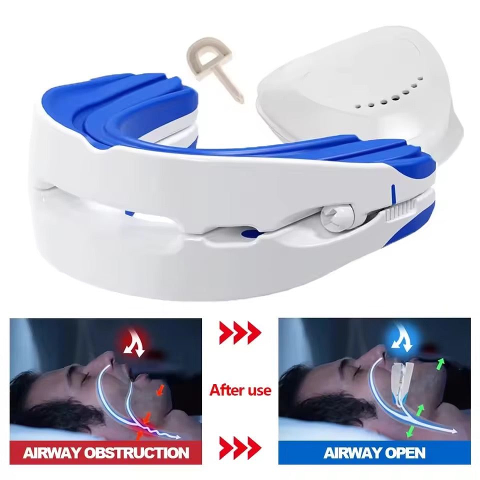 snoring mouth guard